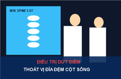 Điều trị dứt điểm thoát vị đĩa đệm cột sống bằng kỹ thuật ít xâm lấn